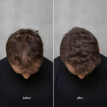 Keratain Thickening Hair Fibers - 25gr