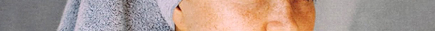 Blog-collagen