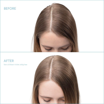 Fibre Clinix Scalp Clinix Oil Control Set - 300+200ml