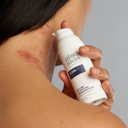 Gladskin Eczemact Cream Reduce Eczema Symptoms