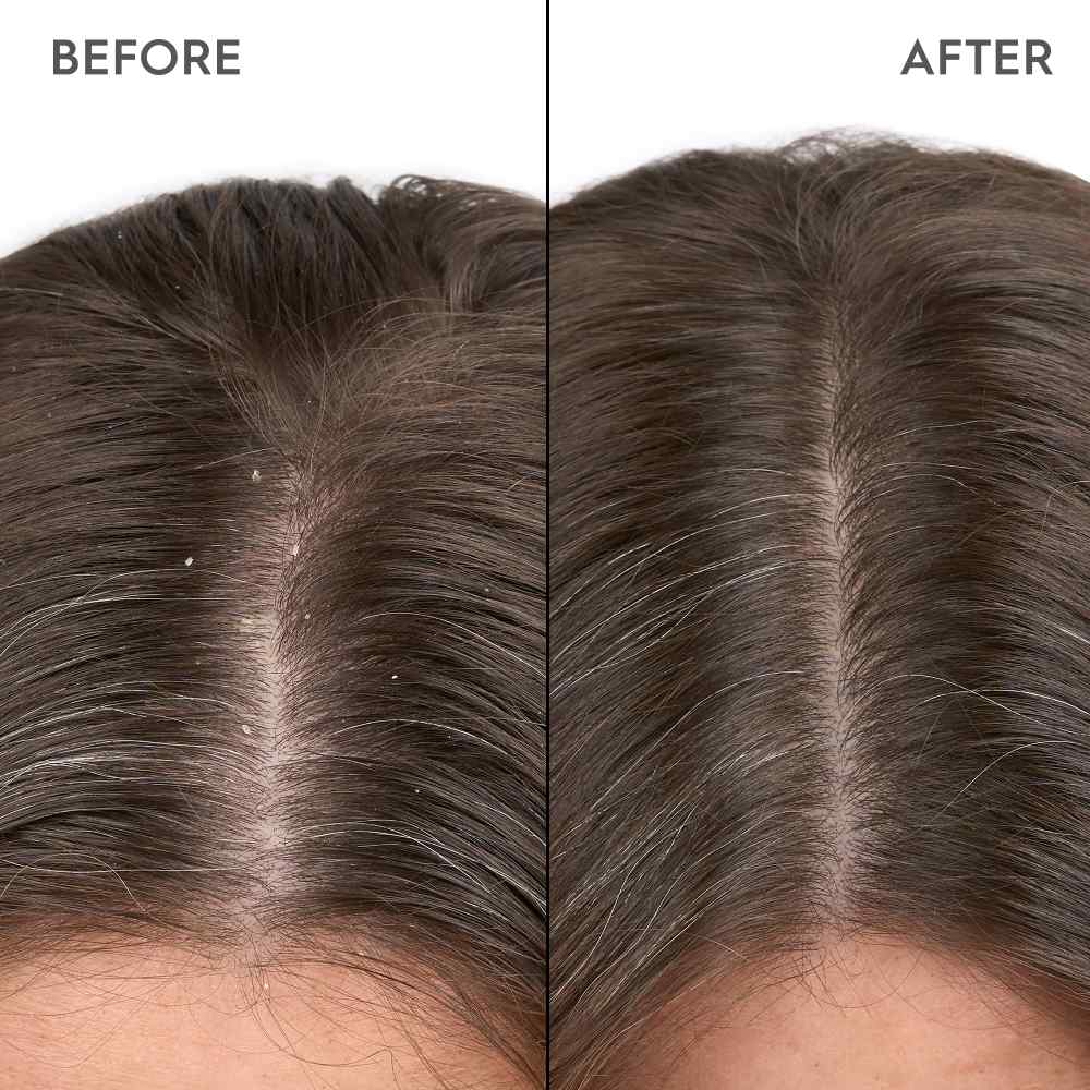 Kerasilk Anti-Dandruff Scalp Serum - 100ml